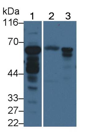 ACSM1 Antibody