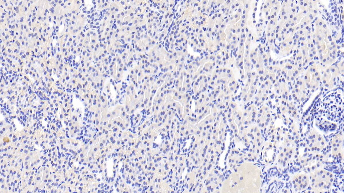 ACSM1 Antibody