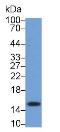 RBX1 Antibody (C6)