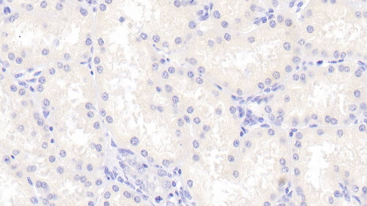 Cerebellin-1/Precerebellin Antibody