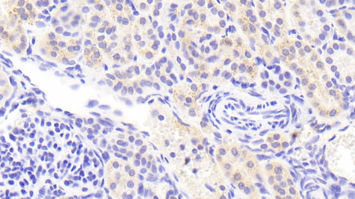 Lgi3 Antibody