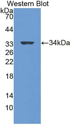 Lgi3 Antibody