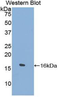 TPSD1 Antibody