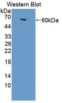 Tau tubulin kinase 2 Antibody