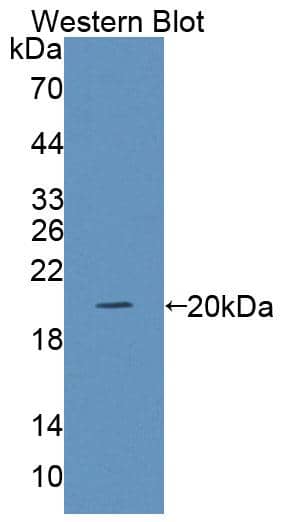 GPR151 Antibody