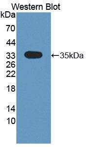 CMTM1 Antibody