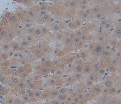 PMM1/Phosphomannomutase 1 Antibody