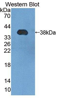 PMM1/Phosphomannomutase 1 Antibody