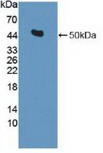 Isocitrate Dehydrogenase 2/IDH2 Antibody