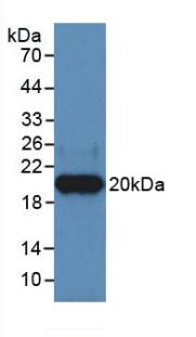 Heparanase/HPSE Antibody (C1)