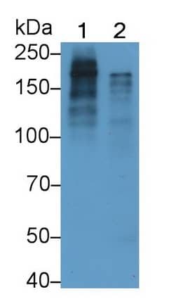 Pappalysin-1/PAPP-A Antibody (C5)