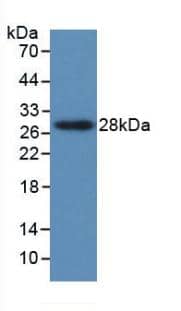 PTHLH/PTHrP Antibody (C2)