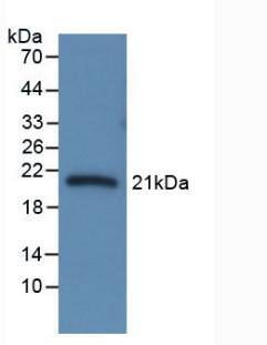 Serpin A6/Cortisol Binding Globulin Antibody (C7)