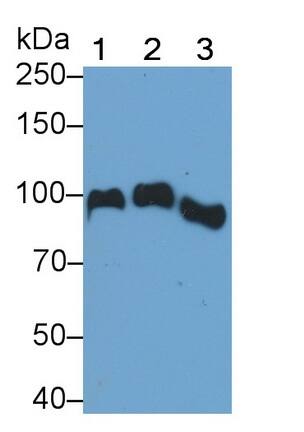 Angiostatin Antibody (C36)