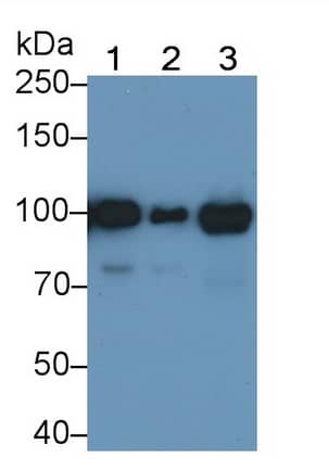 Angiostatin Antibody (C7)