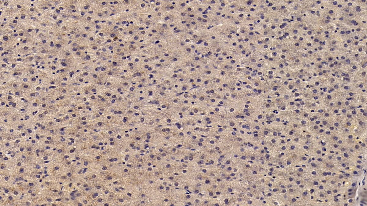 Angiostatin Antibody (D3)