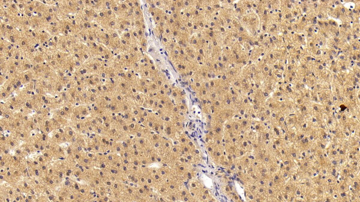 Angiostatin Antibody (C34)