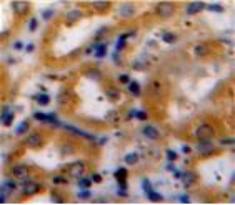 COL15A1 Antibody