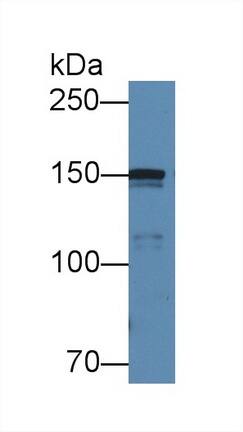 Collagen IV alpha5 Antibody