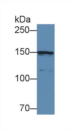 Collagen IV alpha5 Antibody