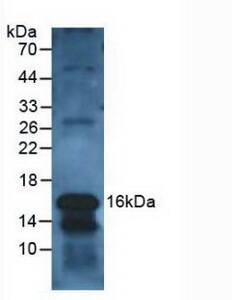 Galectin-10 Antibody