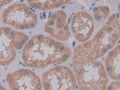 Galectin-10 Antibody