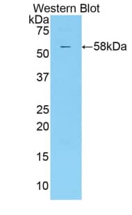 KIR2DS2 Antibody