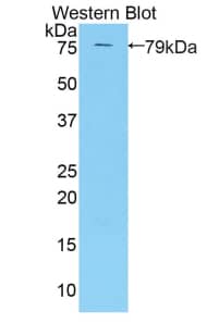 KIR3DL3/CD158z Antibody