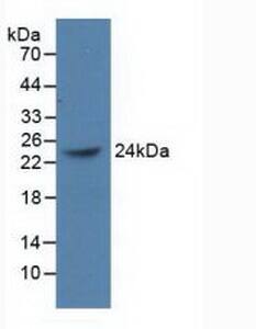 BMI-1 Antibody