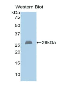 Exostosin 1 Antibody