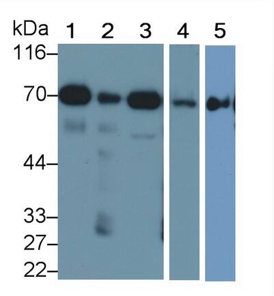 SDHA Antibody (C2)