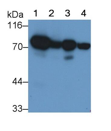 SDHA Antibody (D1)