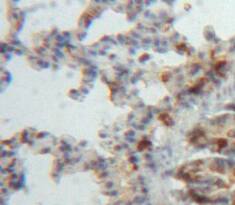 ADAMTS8 Antibody