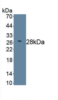 Dkk-2 Antibody (C1)