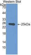 NG2/MCSP Antibody (6#)