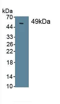 Prosurfactant Protein C Antibody (D3)