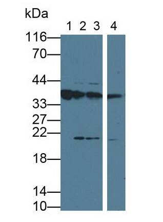 Orosomucoid 2 Antibody (D7)