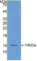 Coagulation Factor VII Antibody (1#)