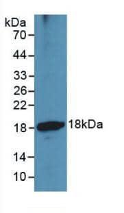 ADAMTS1 Antibody (3#)