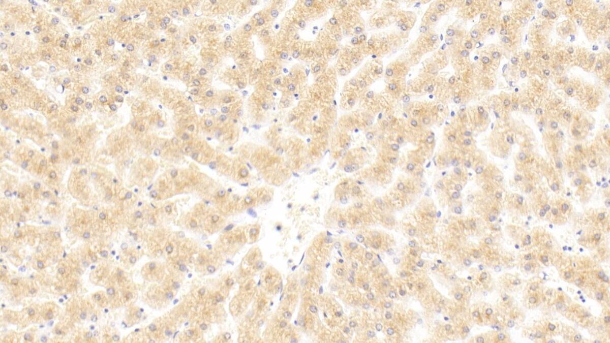 Complement C4b Antibody (C1)