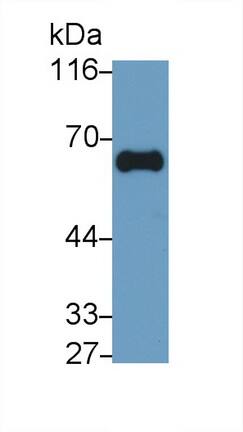GGT1 Antibody (C1)