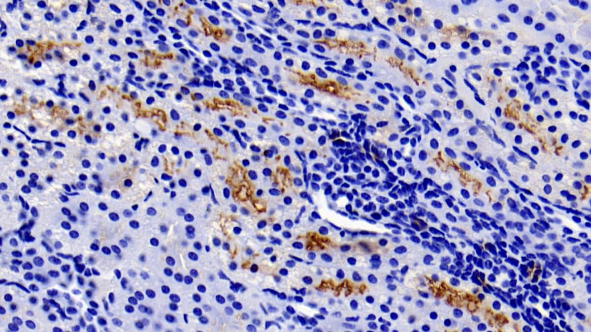 GGT1 Antibody (C1)