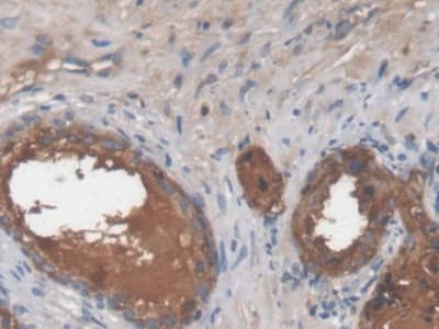 Galectin-3BP/MAC-2BP/LGALS3BP Antibody (D5)