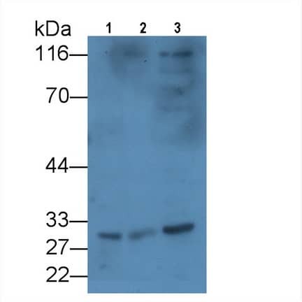 KIR2DS4/CD158i Antibody (C15)