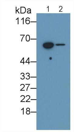 IL-10 R beta Antibody (C1)