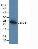 Galectin-3BP/MAC-2BP/LGALS3BP Antibody (D4)