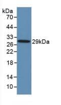 TLR8 Antibody (D2)