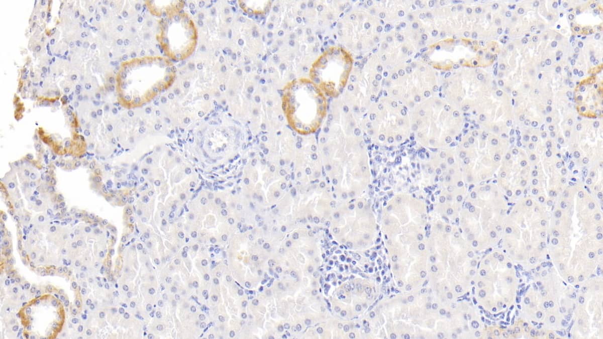 LBP Antibody (C1)