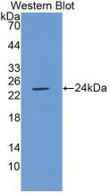 PLA2G4A Antibody (C19)