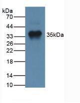 GDF-8/Myostatin Antibody (A11)